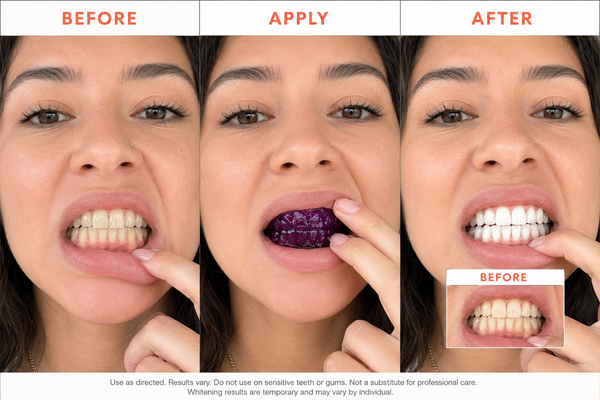 Purple Whitening Strips: Visibly Whiter in One Use